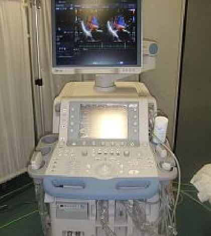 心臓血管（循環器用）超音波診断装置
