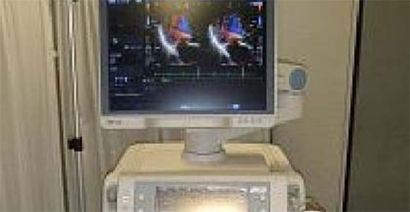 心臓血管（循環器用）超音波診断装置